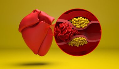 Study: Glucagon‐Like Peptide‐1 Receptor Agonists and Cardiovascular Events in Adults With Obesity and Autoimmune Disease: A Target Trial Emulation. Image Credit: Nemes Laszlo / Shutterstock