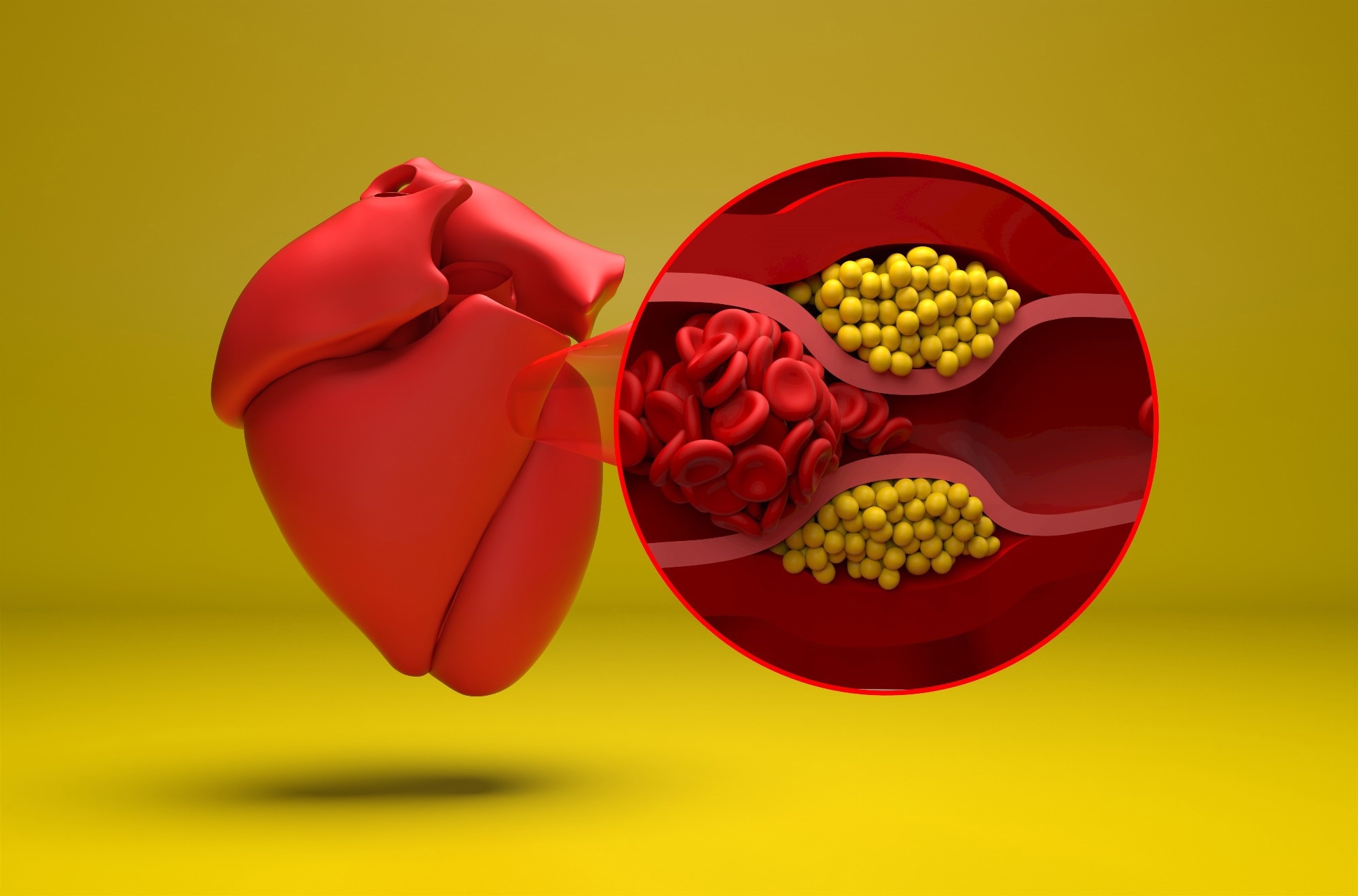 Study: Glucagon‐Like Peptide‐1 Receptor Agonists and Cardiovascular Events in Adults With Obesity and Autoimmune Disease: A Target Trial Emulation. Image Credit: Nemes Laszlo / Shutterstock