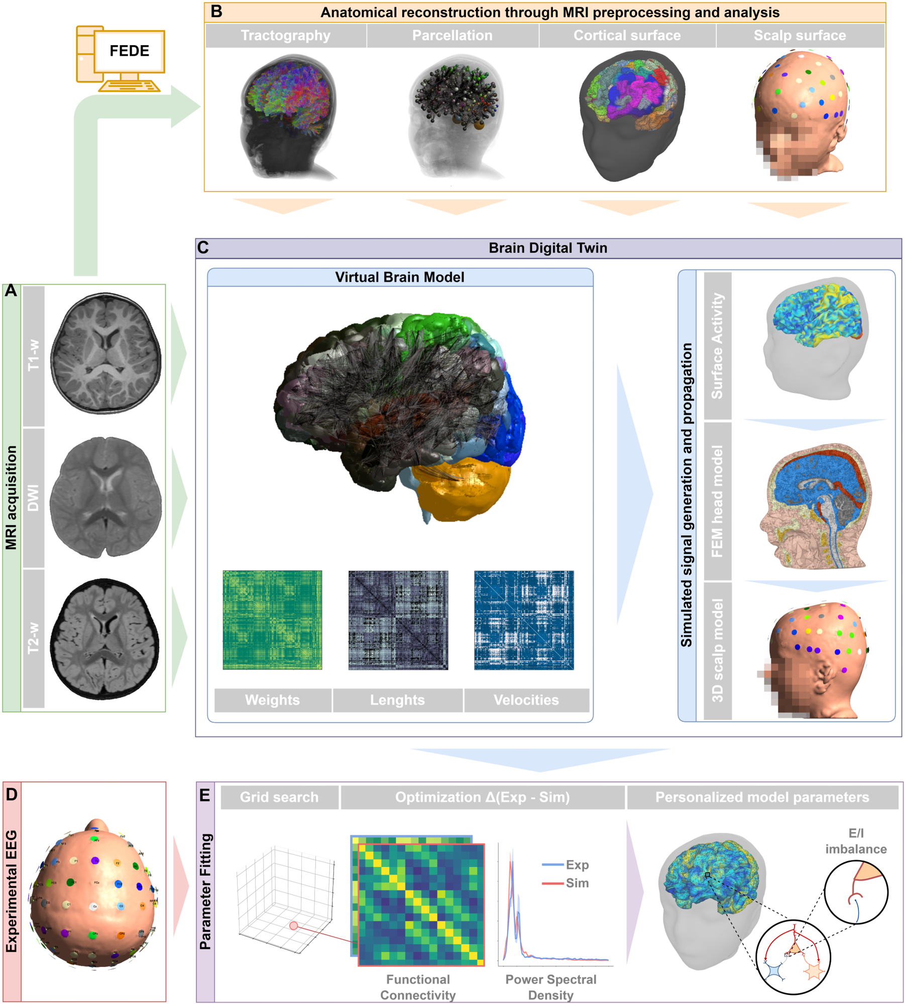 (A): MRI recordings, including (from top to bottom) T1-w, DWI and T2-w, were used to generate a 3D replica of the patient brain. (B): MRI processing steps, from left to right: anatomical constrained tractography analysis, brain regions parcellation and segmentation with reconstruction of cortical surface, reconstruction of biophysical finite element method (FEM) model of the patient’s head, including 3D scalp model with EEG electrodes. (C): Left: the parcellation of brain areas defined connective weights, distances and conduction velocity maps for the whole brain structure, which were integrated in a virtual brain model (top, see Methods). Right: neural activity was computed on the high-density cortical surface, the activity was then projected to the scalp of the patient with an anatomically-accurate lead-field matrix, leveraging the FEM model of the patient’s head and considering anisotropy of brain tissues. This allowed for the precise computation of EEG signal from simulated brain activity. (D): EEG recordings were acquired during resting-state, extracting features such as power spectral distribution and functional connectivity. (E): Parameter optimization through the comparison between experimental and simulated EEG led to the identification of multi-scale structural features underlying patient’s condition.