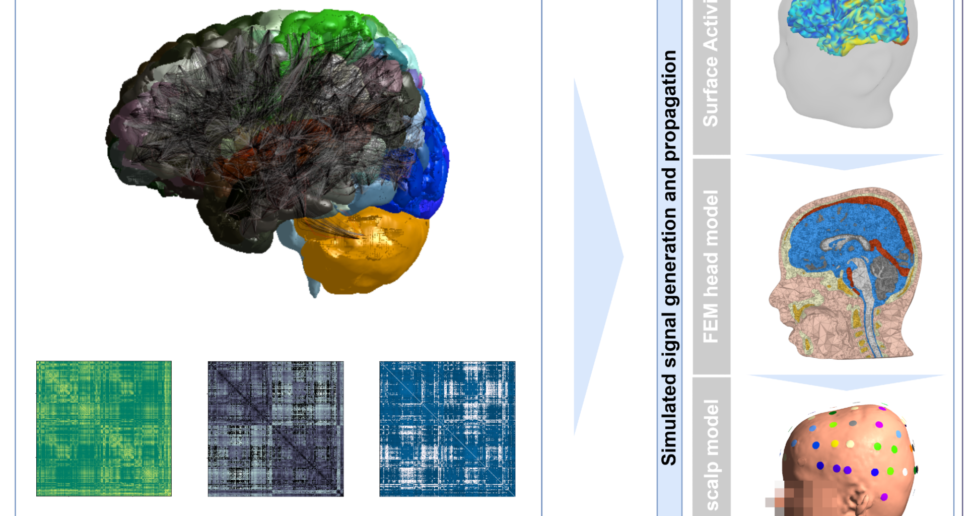 Digital brain twin recreates brain activity in a toddler with autism