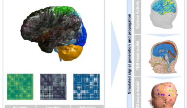 Digital brain twin recreates brain activity in a toddler with autism