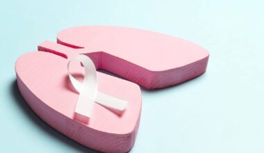 Lung Cancer Prediction Models Inaccurate Across Racial and Ethnic Groups