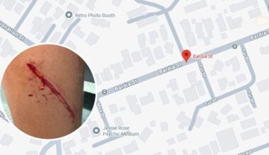 Auckland boy traumatised after dog attack while cycling in Belmont