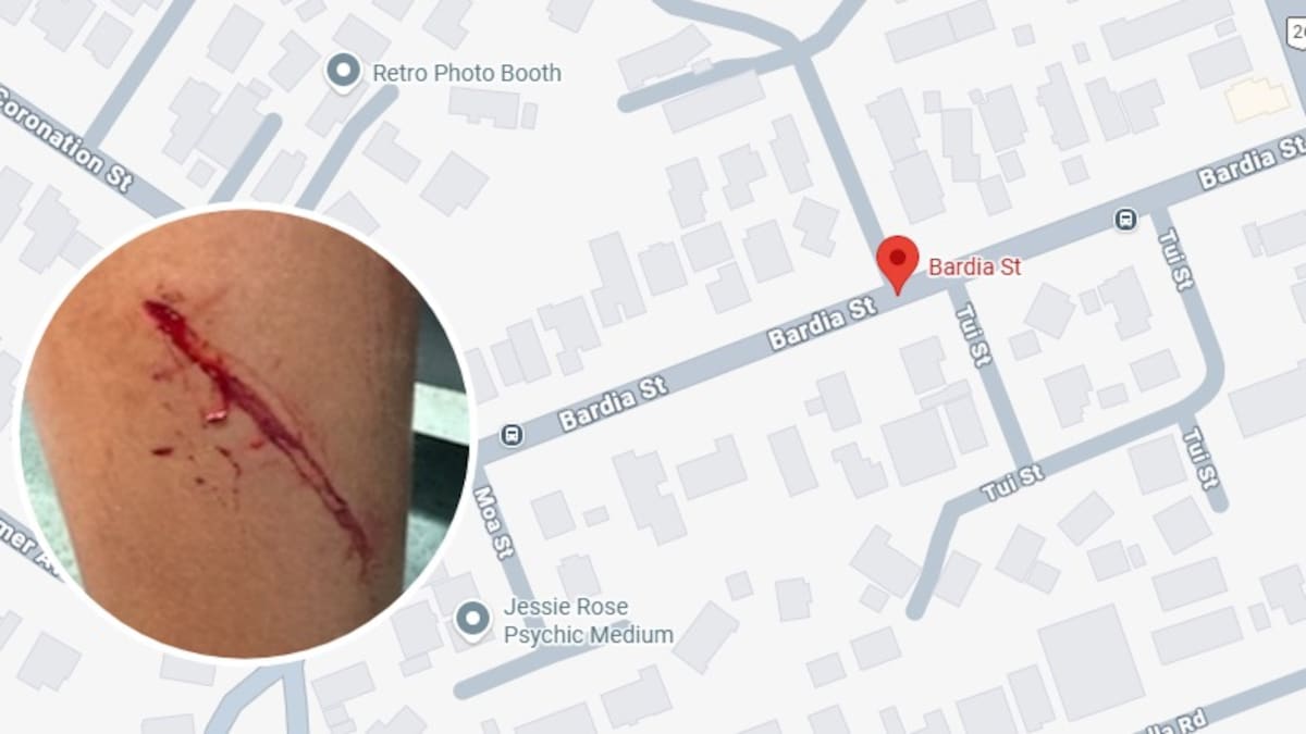 Auckland boy traumatised after dog attack while cycling in Belmont