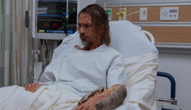'The Pitt' Makeup Head Unpacks the Show's Goriest Moments