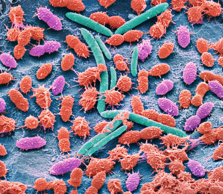 Common Drugs Can Rewire Your Gut For Several Years, Study Finds