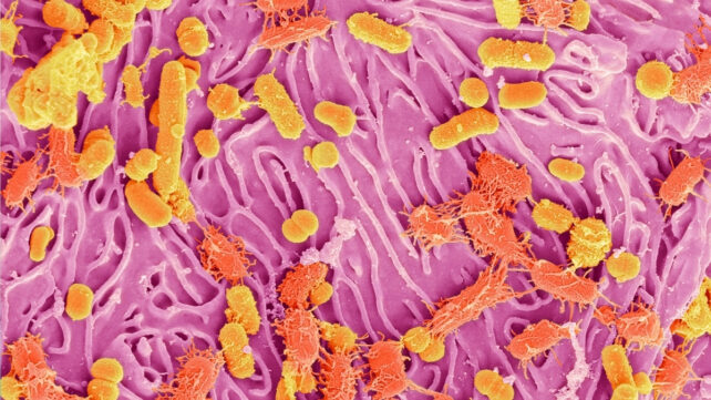 orange and yellow bacteria on a pink surface