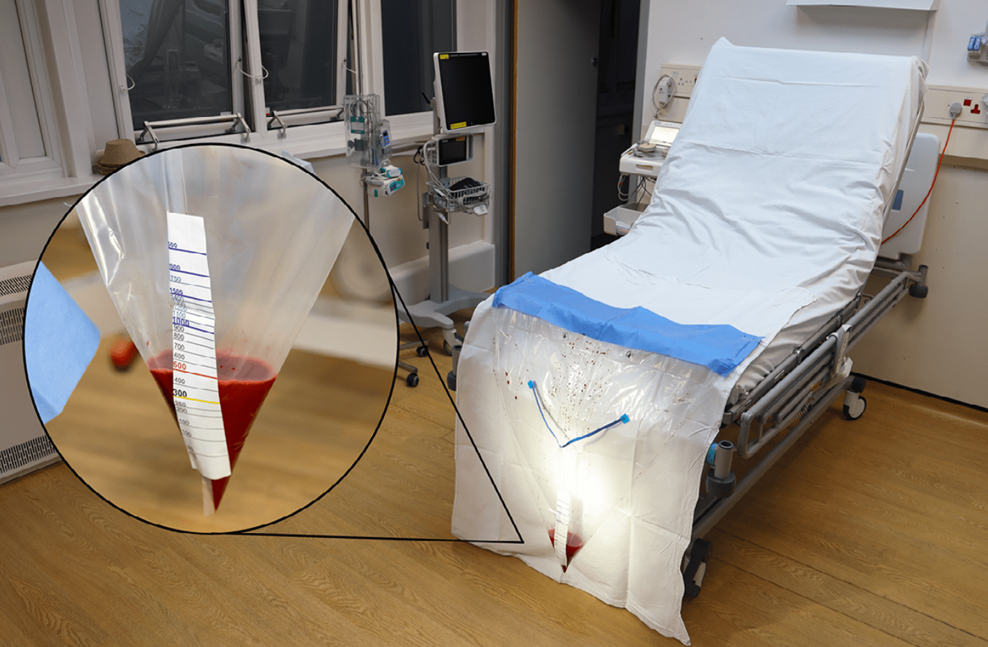 Saving Women From Bleeding To Death After Giving Birth