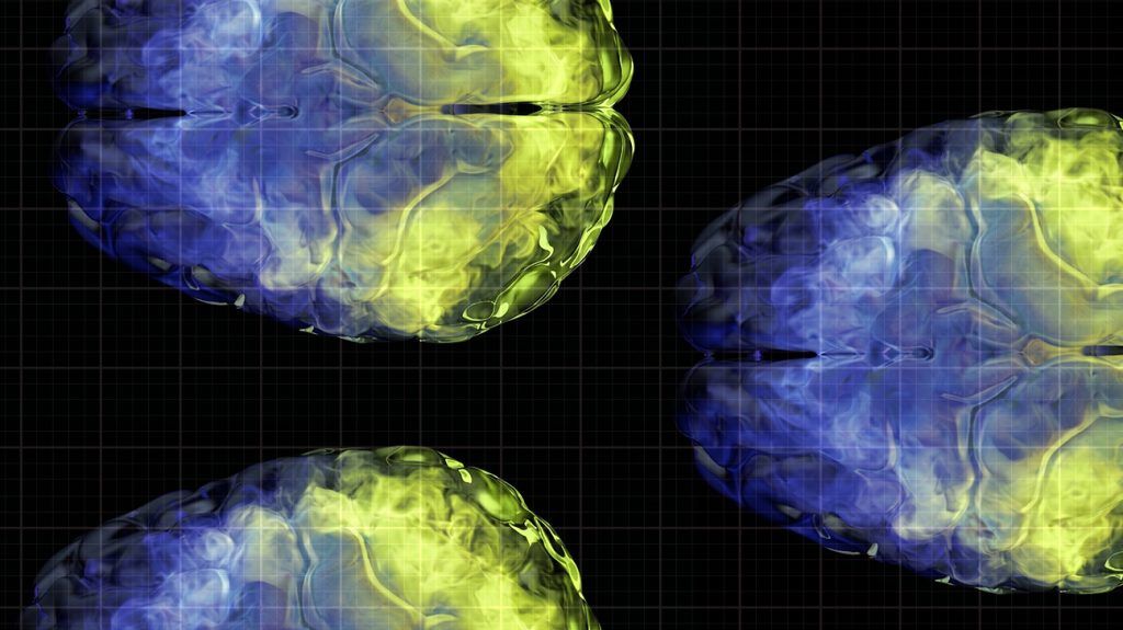 color gradient brain scans
