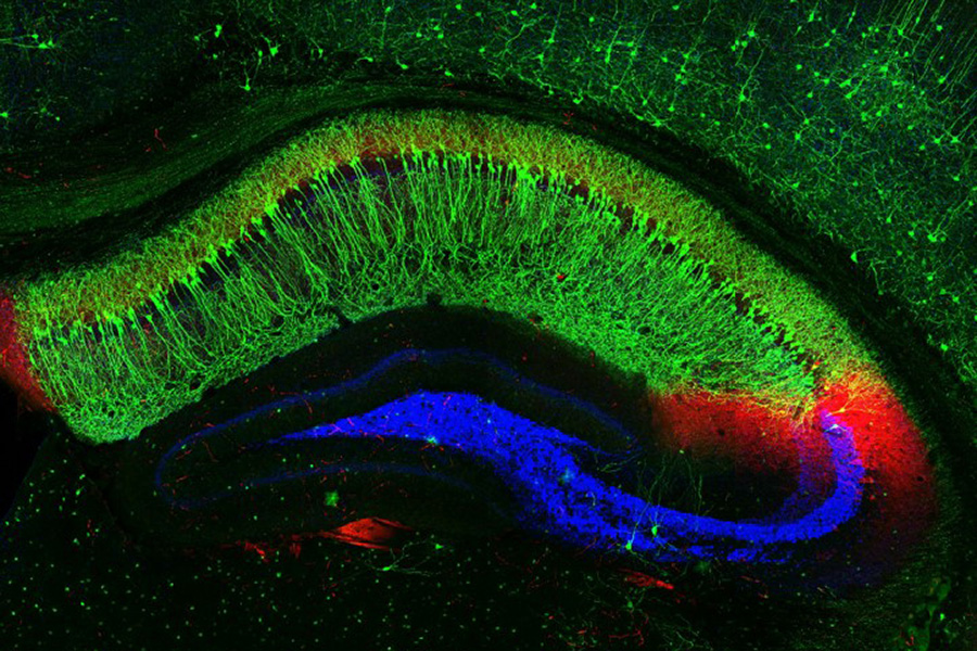 A scan of a bean-shaped mouse brain, showing mostly green with blue and red on the edges.