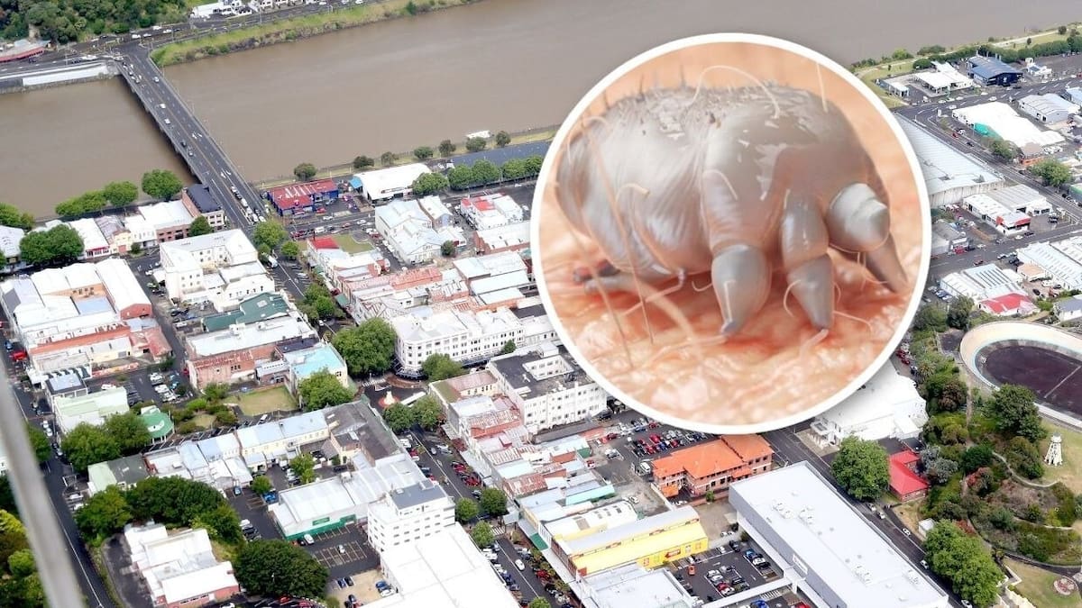 Scabies spread in Whanganui continues with ‘massive’ increase in cases