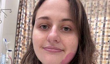 21yo denied bowel cancer test gets stage 3 diagnosis five years later