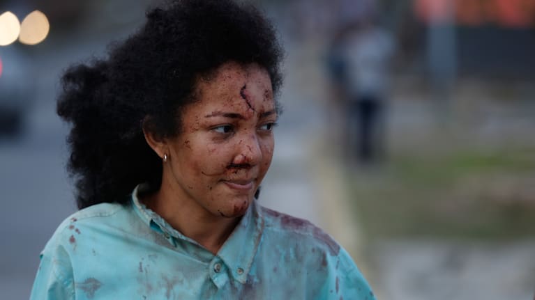 An injured woman walks in La Guaira, Venezuela, a day after an earthquake struck the area, Thursday, June 25, 2026.