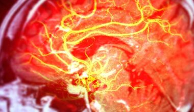 Researchers Harness the Body’s Internal Clock to Improve Stroke Recovery