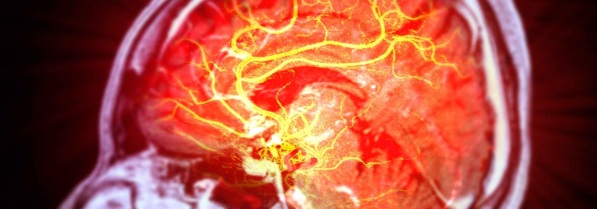 Researchers Harness the Body’s Internal Clock to Improve Stroke Recovery