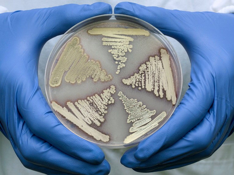 Close-up view of colonies of Streptomyces coelicolor bacteria growing on an agar medium in a petri dish held by a laboratory researcher.