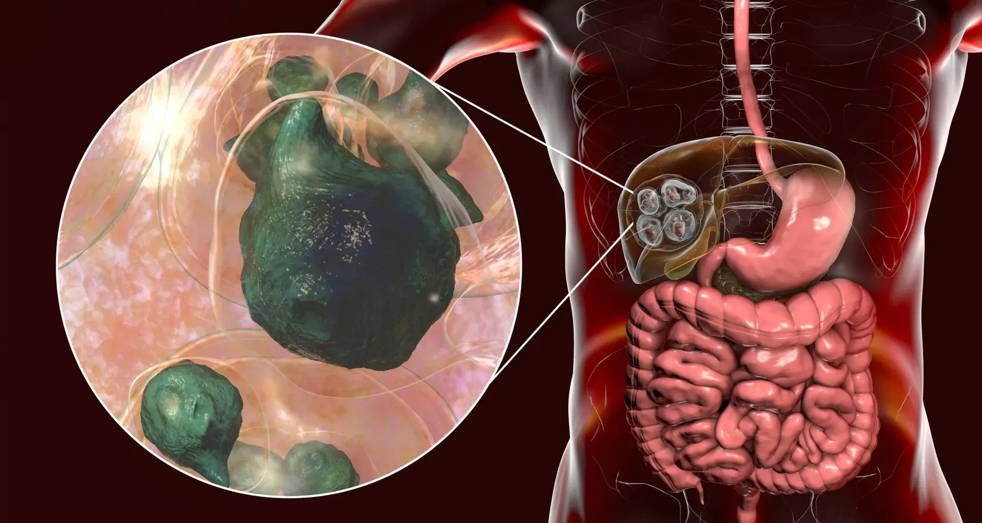 The deadly tapeworm spreading across America has reached the Pacific Northwest