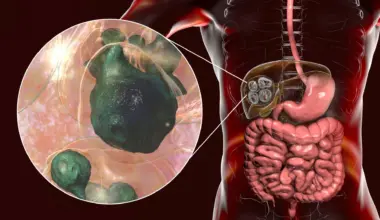 The deadly tapeworm spreading across America has reached the Pacific Northwest