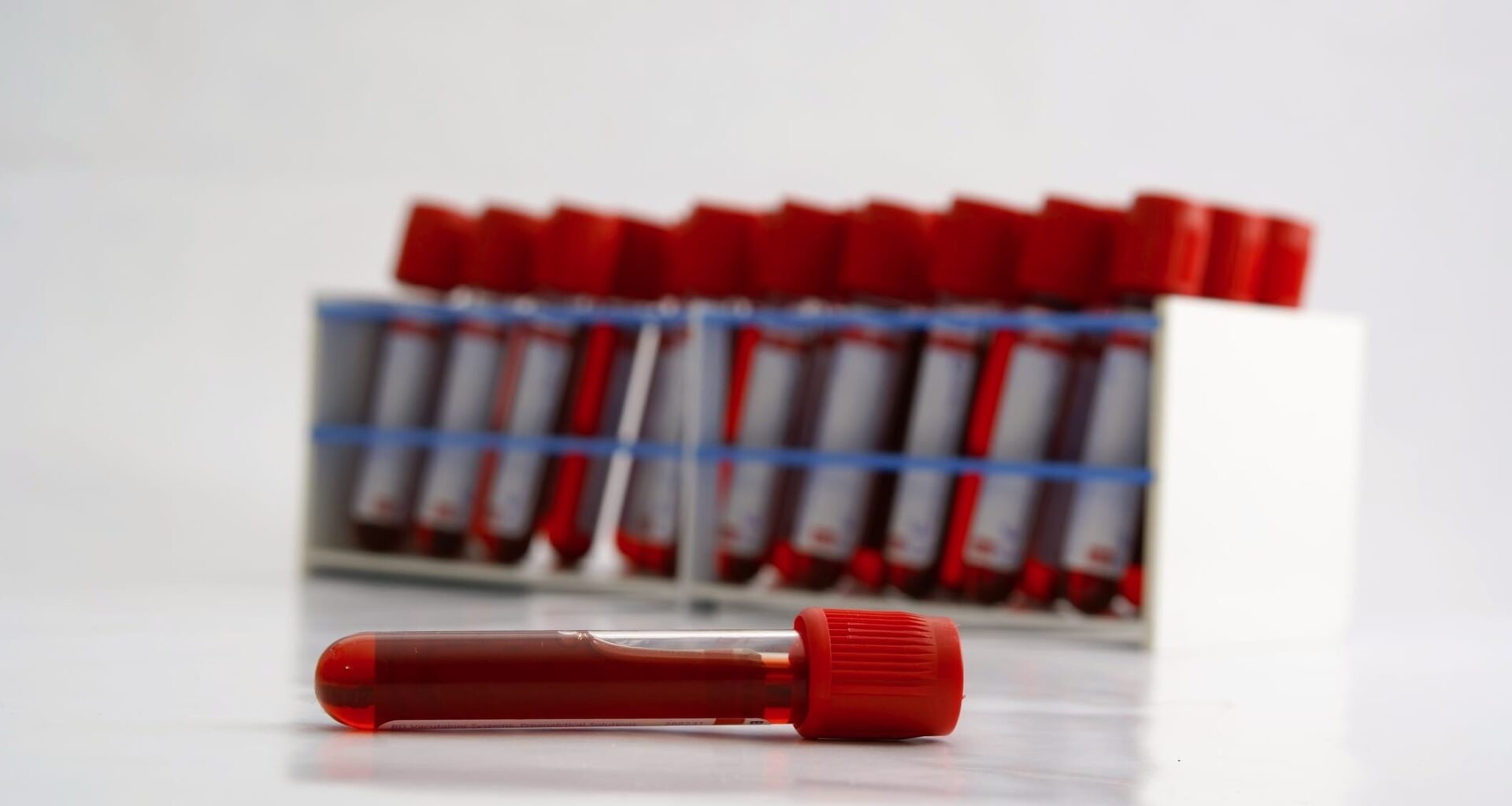 City of Hope Develops Blood Test for Early Colorectal Cancer Detection