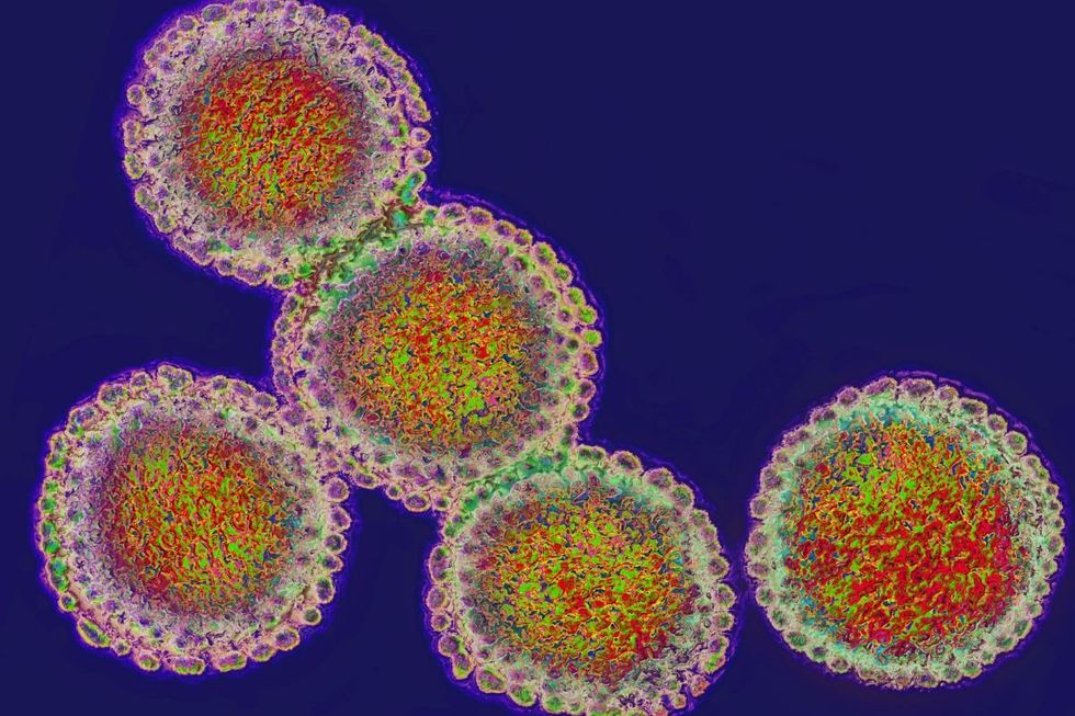 influenza strain under microscope