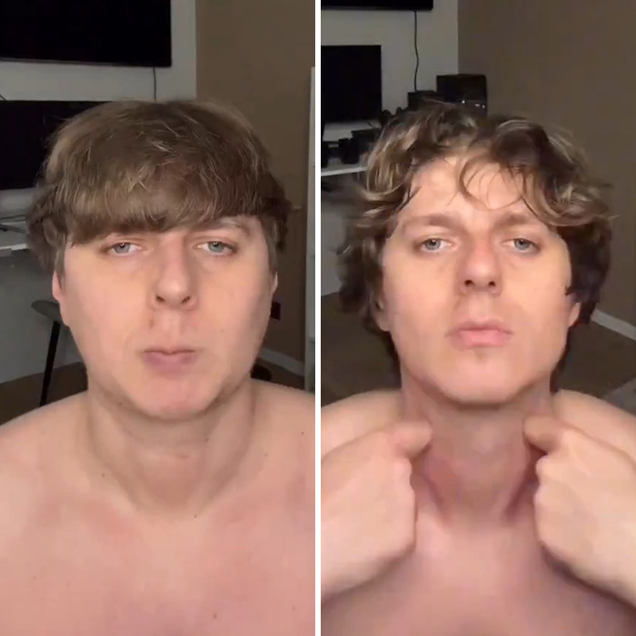 Before and after images showing jawline change after 80 days of jaw exercises