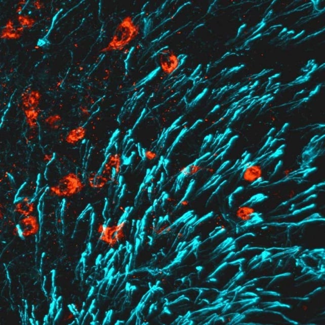 New Breakthrough to Strengthen Bone Could Reverse Osteoporosis