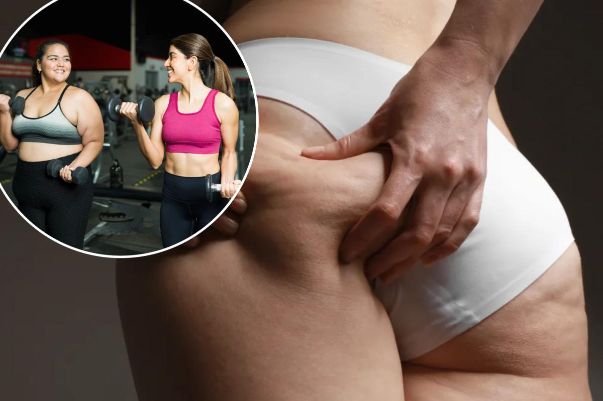 New drug could fight 'Ozempic butt' and other unwelcome side effects