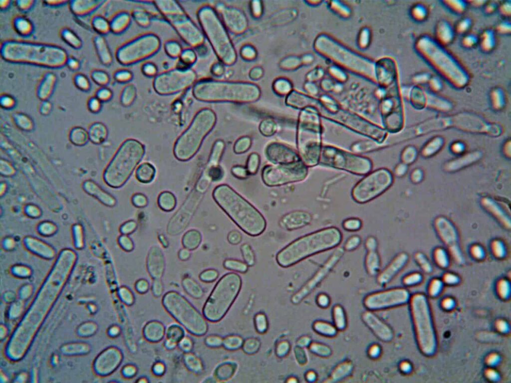 Microscopic view of bacteria cells showing diverse shapes and sizes.