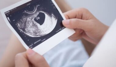 Labour pledges free maternity scans on promised Medicard