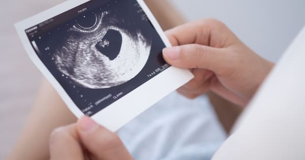Labour pledges free maternity scans on promised Medicard