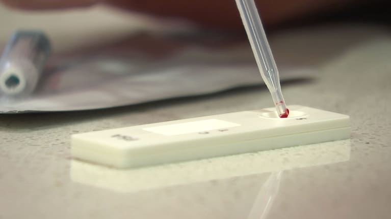 Prostate cancer blood test.