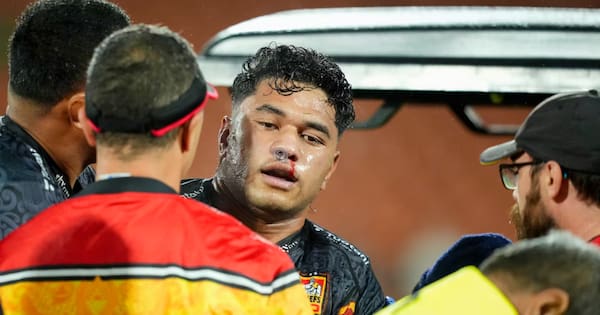 All Blacks star hospitalised after head knock in Chiefs qualifying final