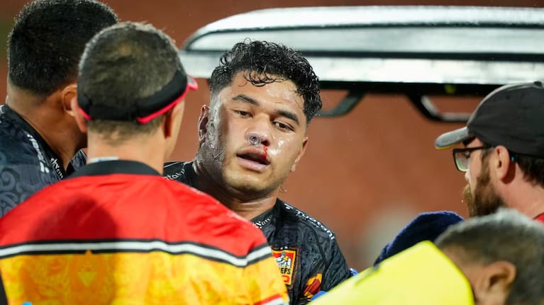 Wallace Sititi leaves the field after a major head knock against the Reds in Hamilton.