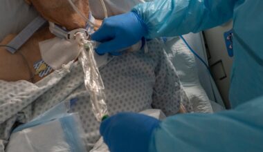 Life-threatening fungal infection that can live on surfaces for weeks is rising in the US
