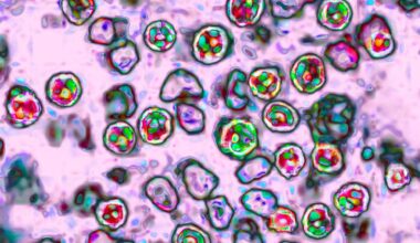 Amid Cyclosporiasis Outbreak, Measles Cases Are Nearing Last Year's Total