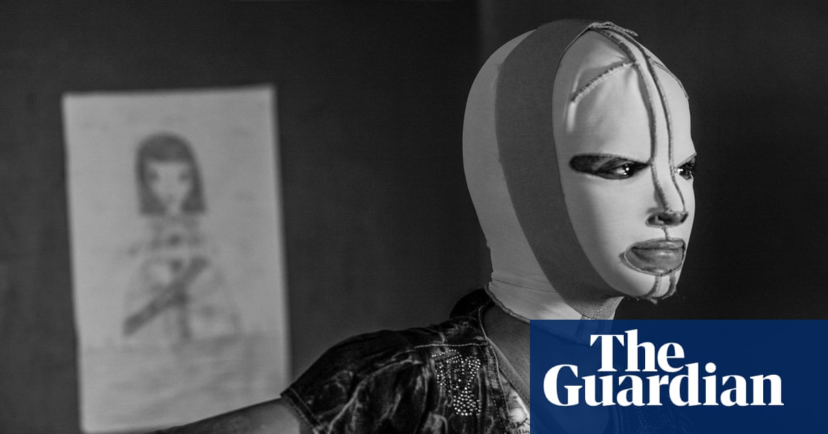 A 12-year-old casualty of war recovers in hospital: Alessio Mamo’s best photograph | Art and design