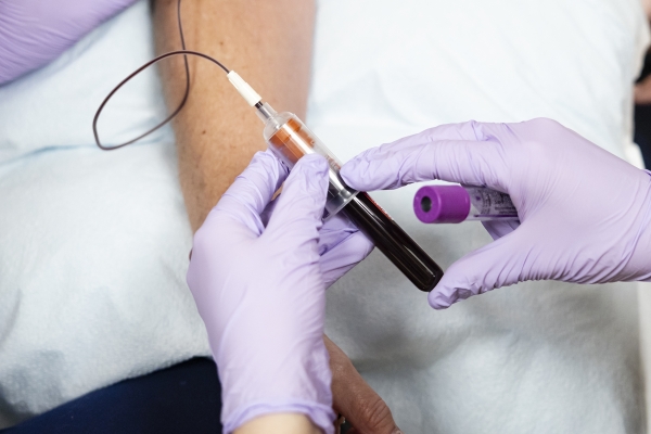 What to know about the powerful new cholesterol pill