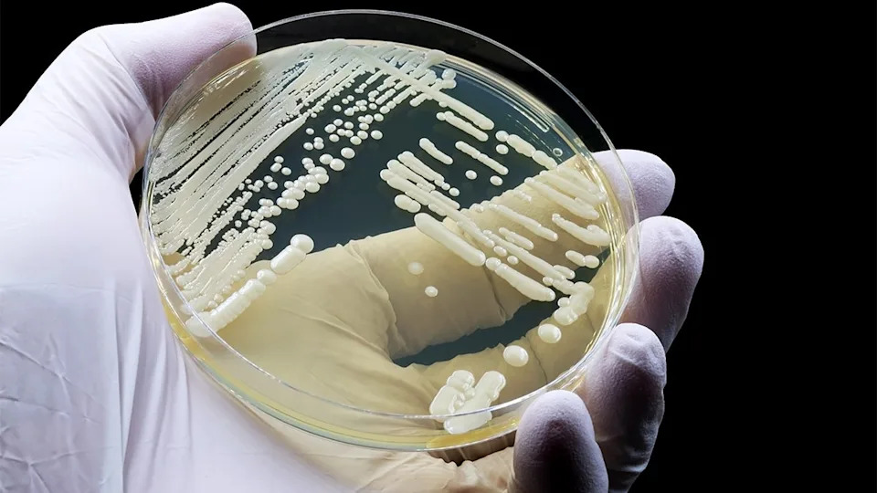 The yeast Candida auris is seen on a petri dish in this photo from the U.S. Centers for Disease Control and Prevention. The CDC warns that exposed to the yeast can spread infections without realizing it (CDC)