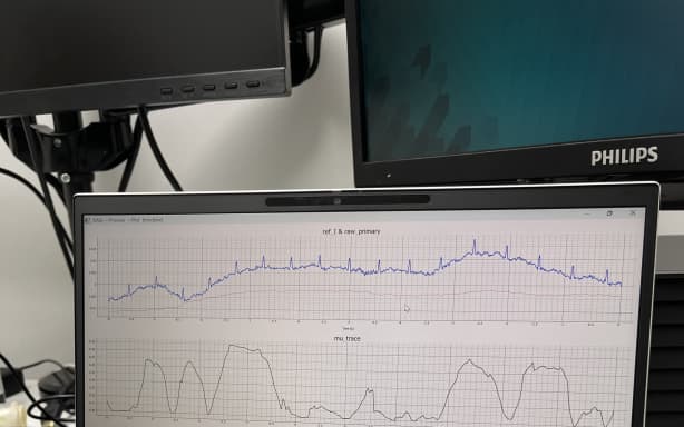 A computer screen showing ECG heartbeat wave forms, a test run of the output from electrodes on chair.