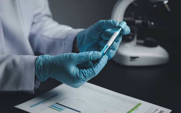 Lab assistant, medical scientist, chemistry researcher holds a glass tube through a chemical test tube, does a chemical experiment and examines a patient's sample. Medicine and research concept.