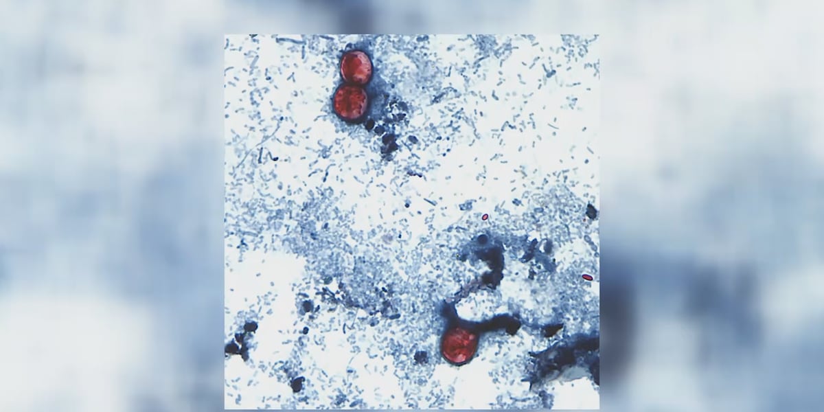 Health care providers warn of severe stomach bug illness in Illinois