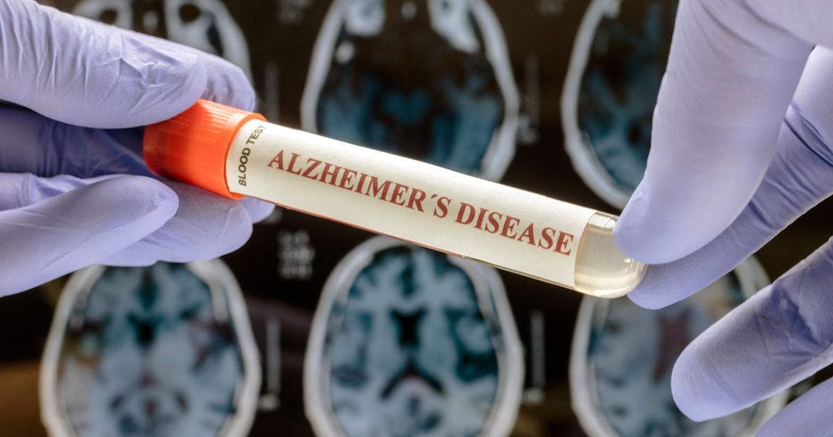 AAIC: Blood-Based Alzheimer’s Biomarkers Gain Ground - insights.citeline.com