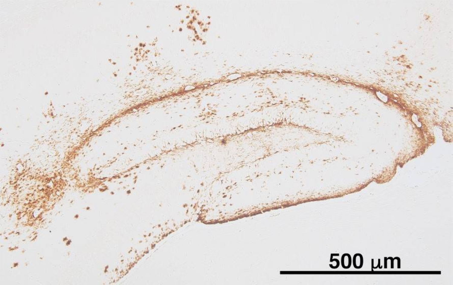 Japan scientists identify clusters of protein believed to trigger Alzheimer’s disease