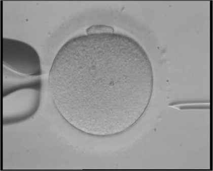 Russia Approves State-Funded IVF for Widows as Birth Rates Hit Historic Low