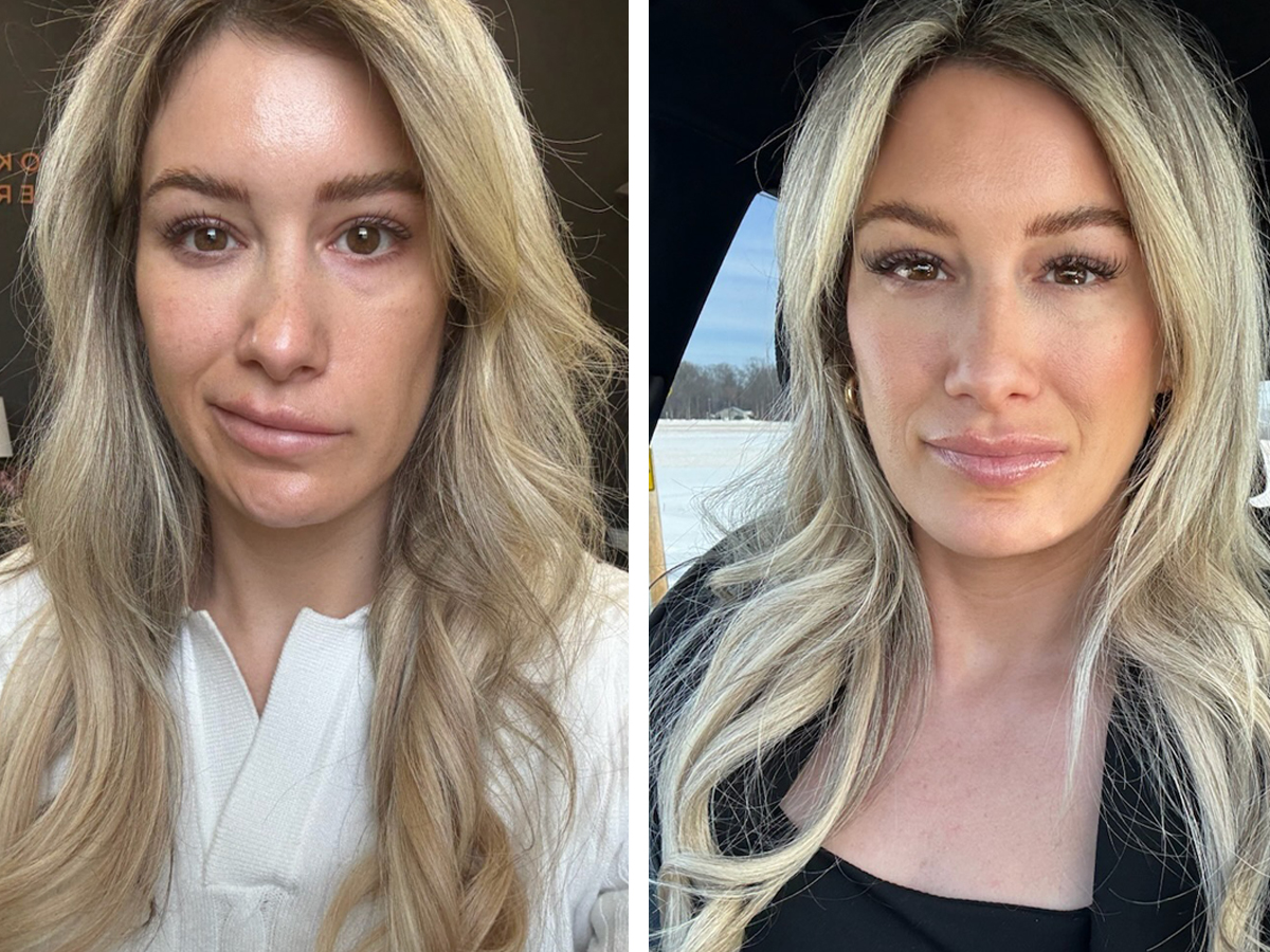 The Medical Minute: A Tick Bite Left Her Face Paralyzed - Specialized Treatment Helped Her Smile Again