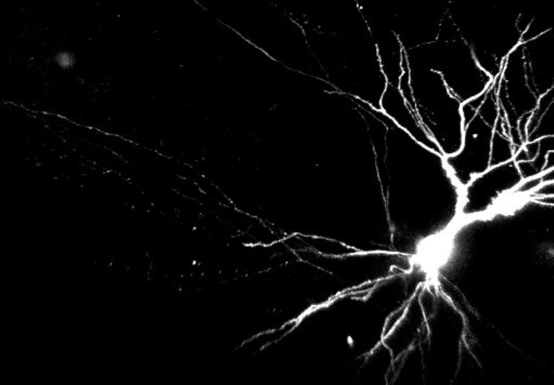 Dendrites may be key to learning and memory, study suggests