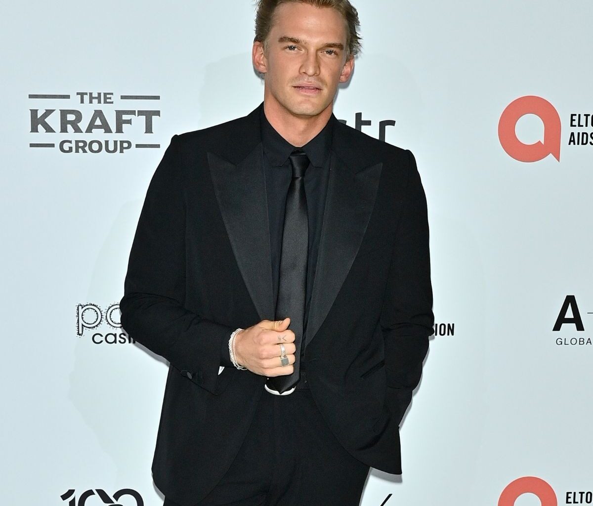 Cody Simpson “Can’t Walk or Talk” After 2 Injuries, Delays Album