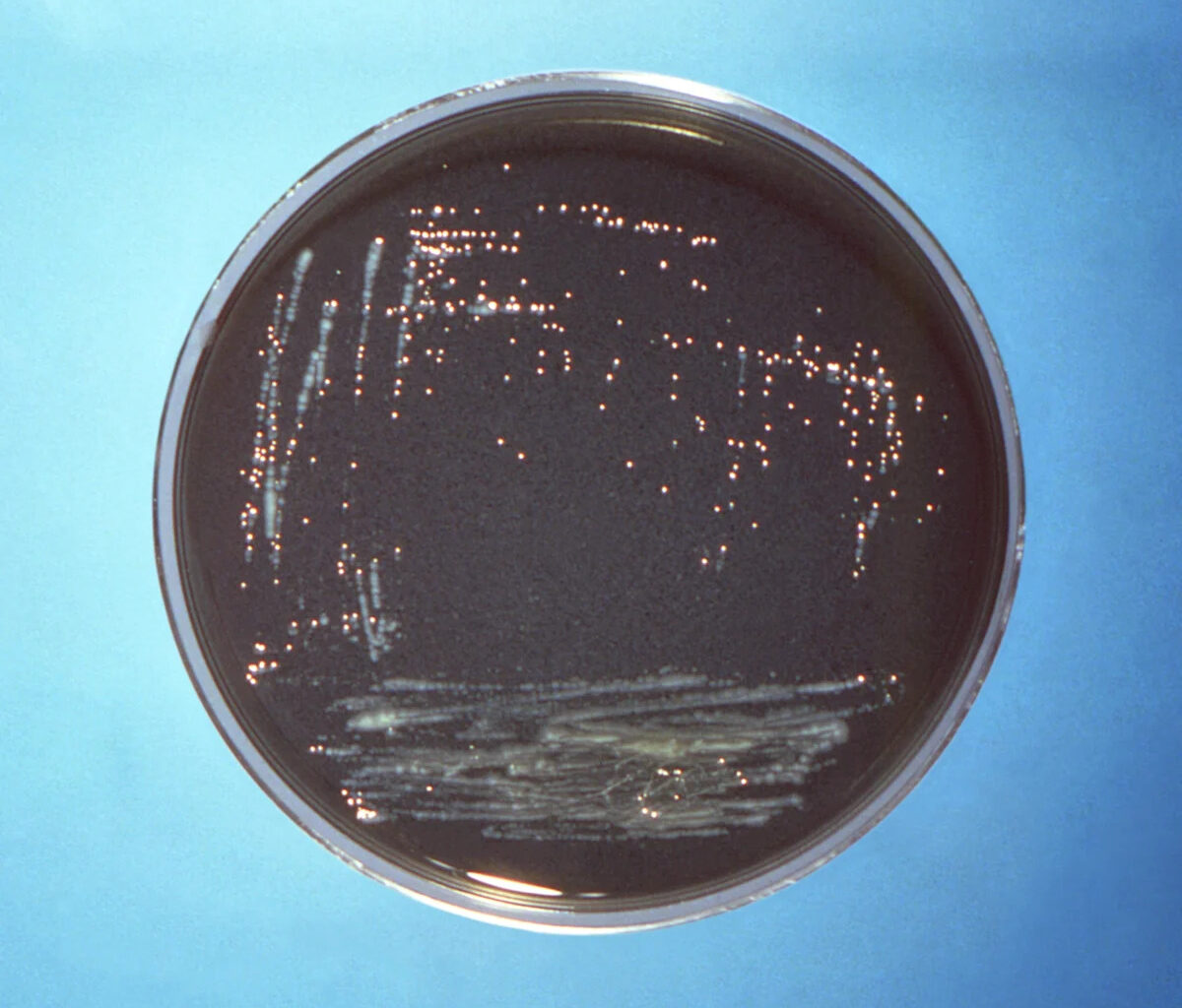 Cases of Legionnaires’ Disease on Manhattan’s Upper East Side jumps to 10: NYC health officials