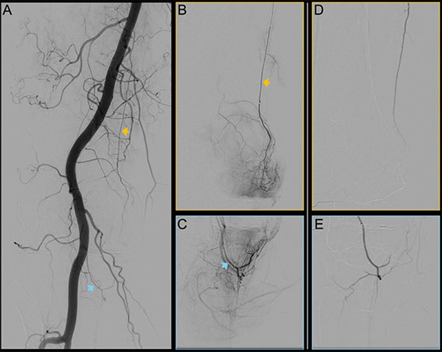 Blood vessel scans