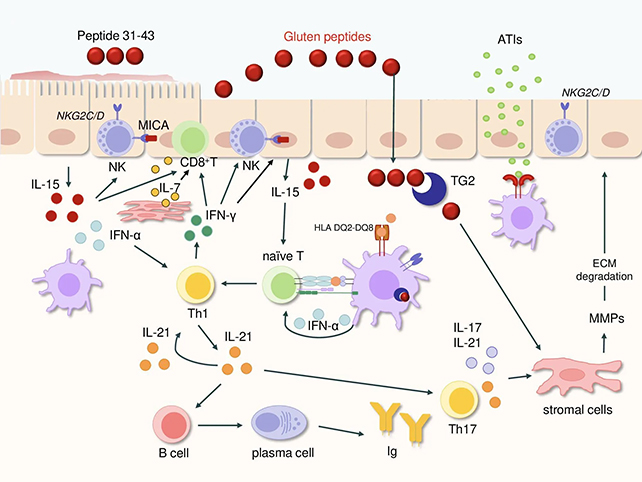 Celiac disease reaction